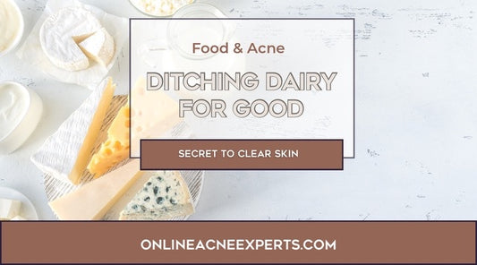 Ditching Dairy: The Secret to Clear Skin for Acne Sufferers