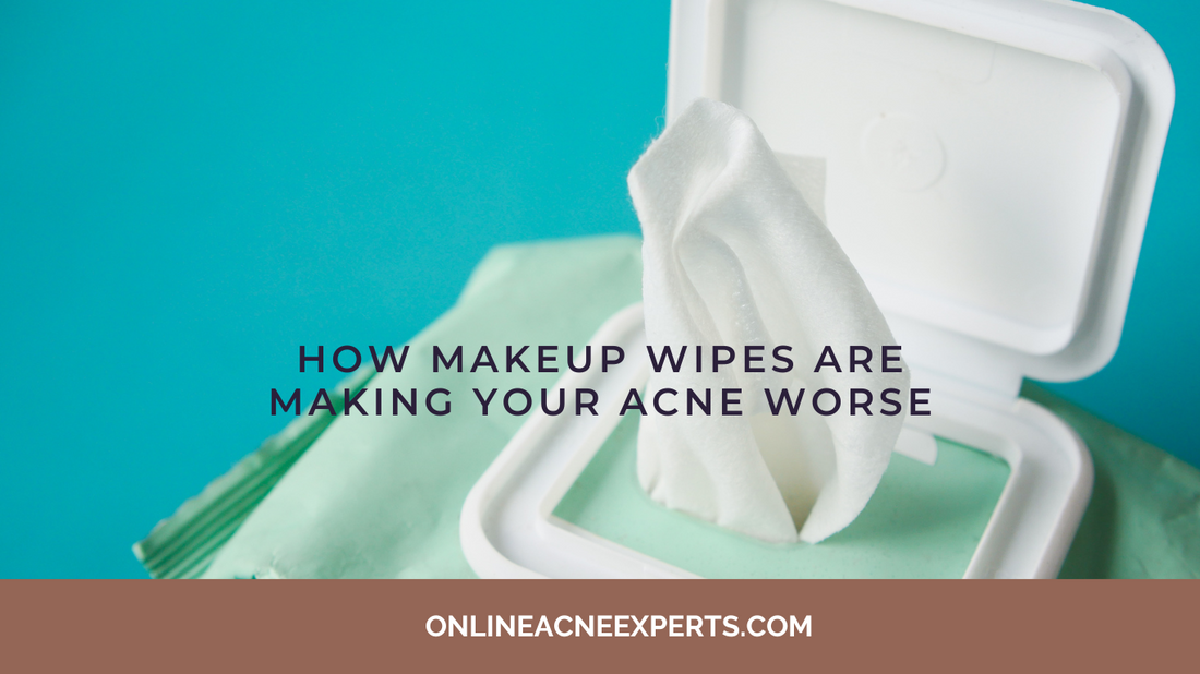 How Makeup Wipes Are Making Your Acne Worse