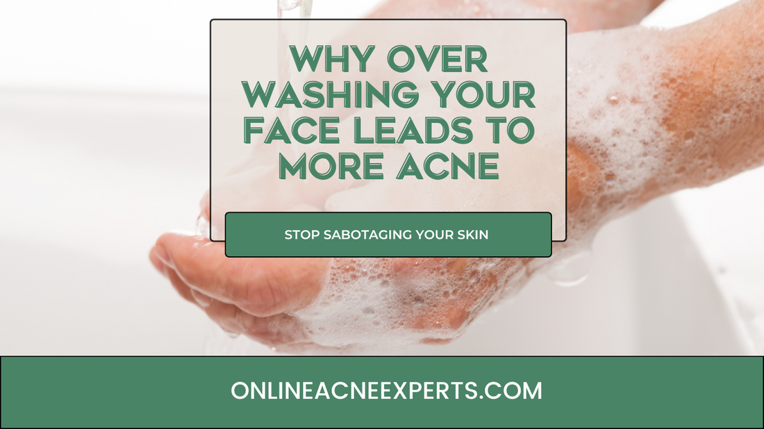 Stop Over Washing Your Face: The Secret to Balanced, Acne-Free Skin