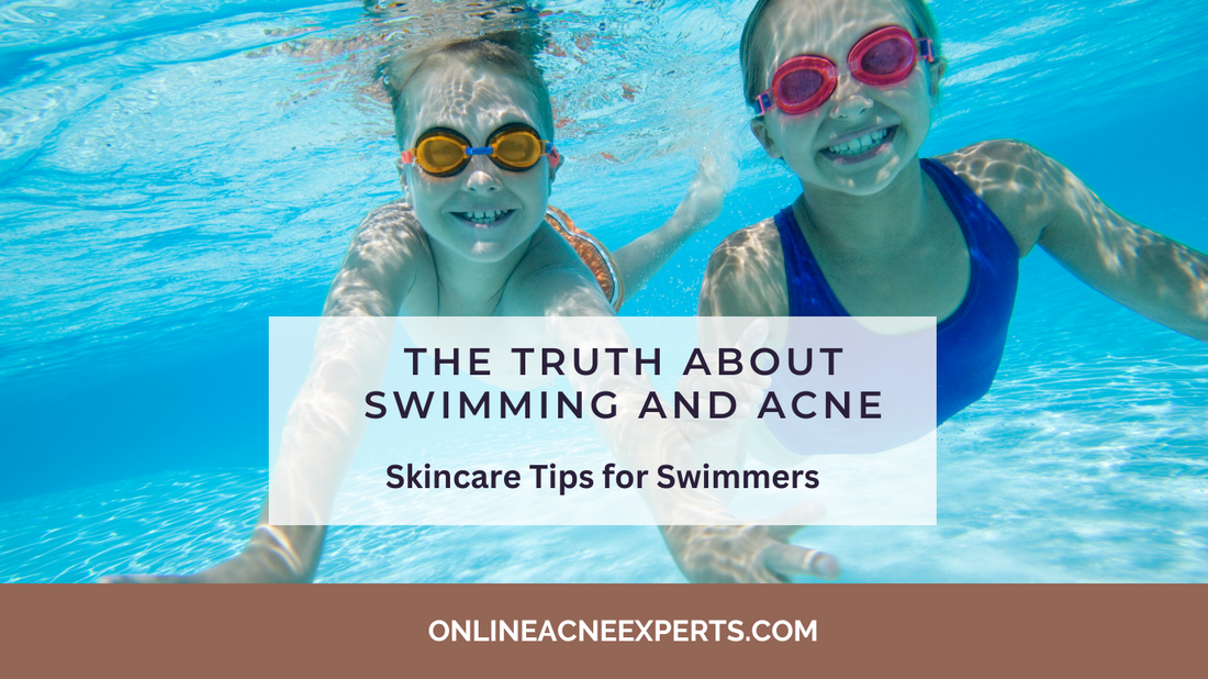 The Truth About Swimming and Acne: Skincare Tips for Swimmers